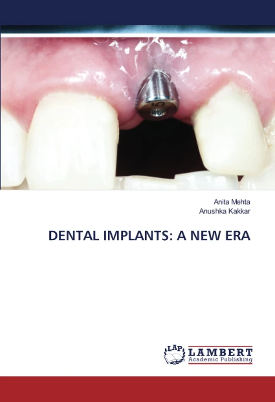 DENTAL IMPLANTS: A NEW ERA