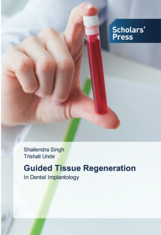 Guided Tissue Regeneration: In Dental Implantology