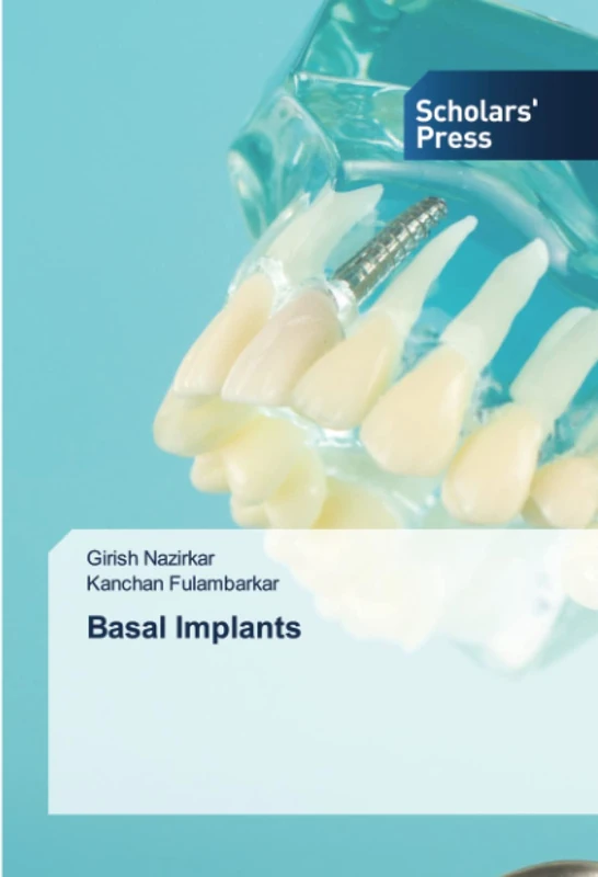 Basal Implants