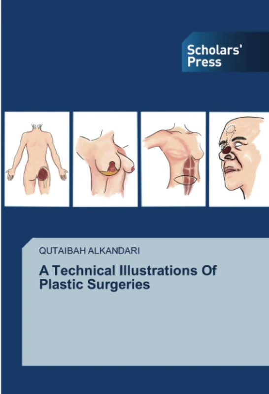 A Technical Illustrations Of Plastic Surgeries