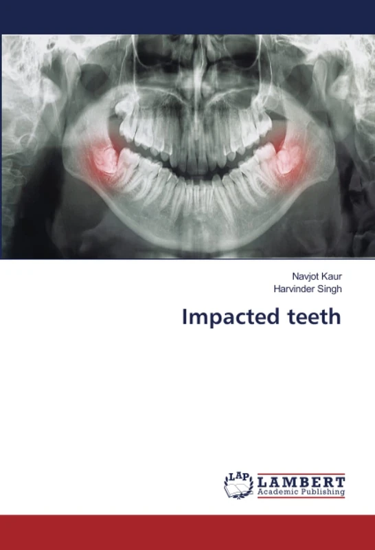 Impacted teeth