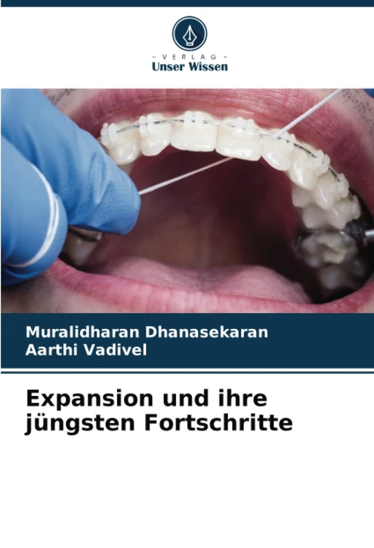 Expansion und ihre jüngsten Fortschritte