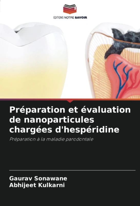 Préparation et évaluation de nanoparticules chargées d'hespéridine: Préparation à la maladie parodontale