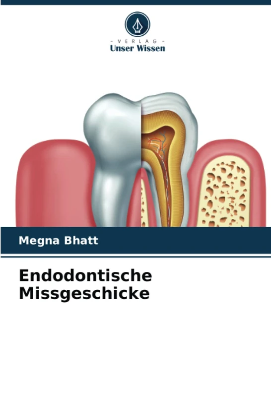 Endodontische Missgeschicke