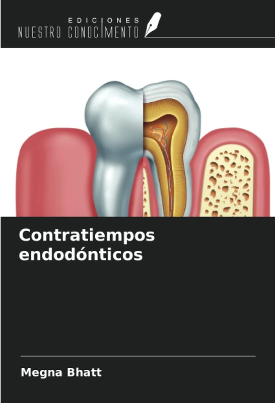 Contratiempos endodónticos