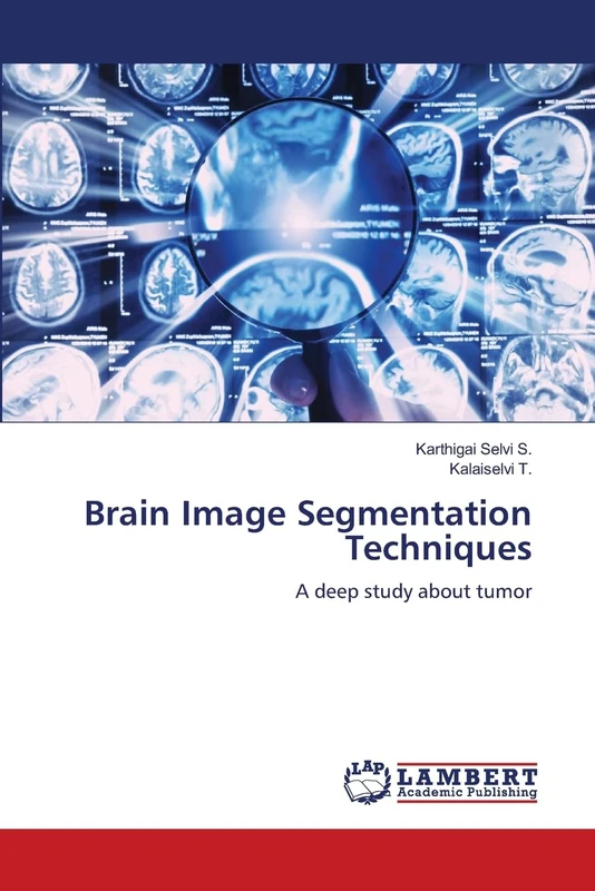 Brain Image Segmentation Techniques: A deep study about tumor - Image 1