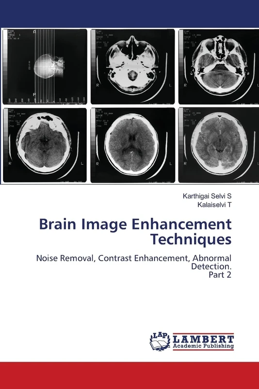 Brain Image Enhancement Techniques: Noise Removal, Contrast Enhancement, Abnormal Detection.Part 2