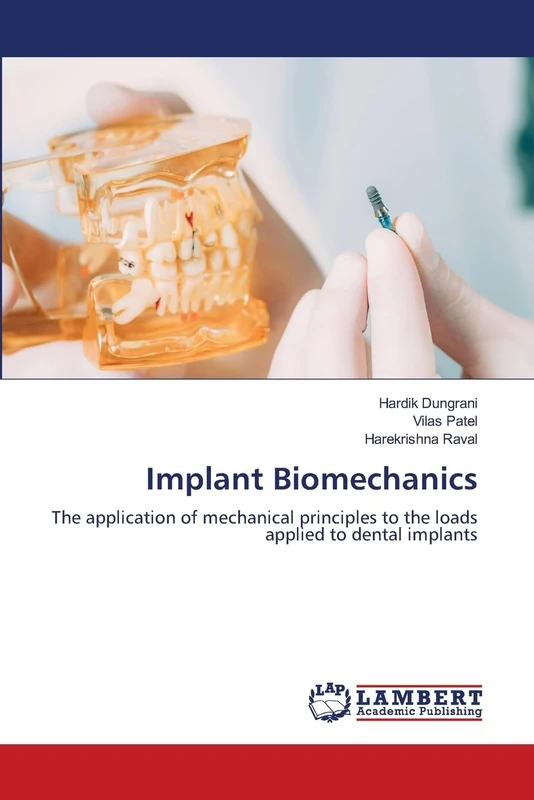 Implant Biomechanics: The application of mechanical principles to the loads applied to dental implants