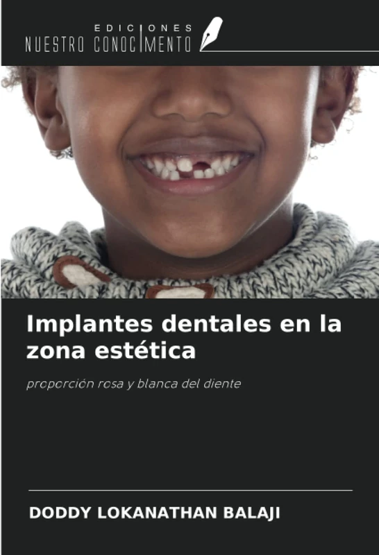 Implantes dentales en la zona estética: proporción rosa y blanca del diente - Image 1