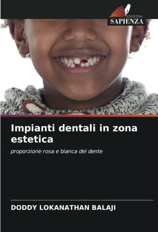 Impianti dentali in zona estetica: proporzione rosa e bianca del dente - Image 1