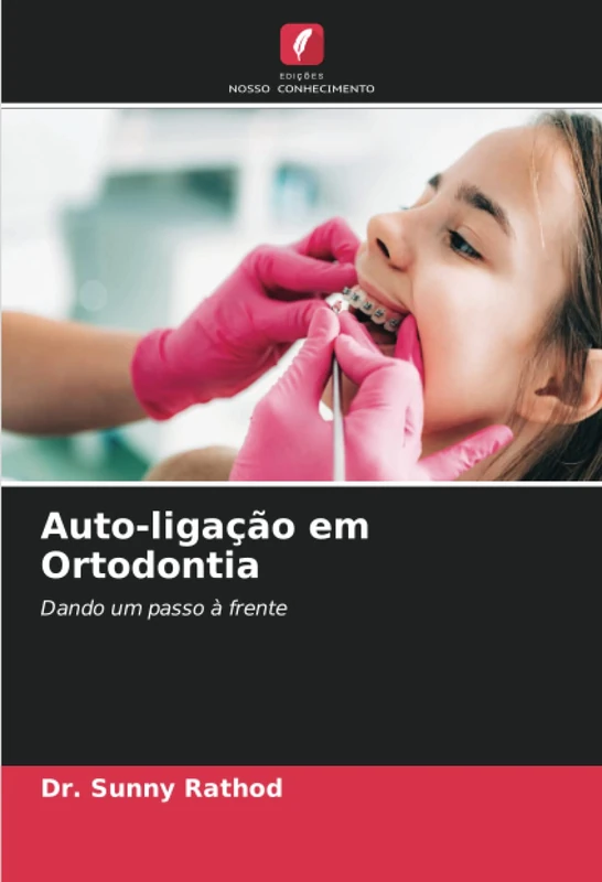 Auto-ligação em Ortodontia: Dando um passo à frente
