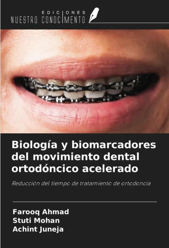 Biología y biomarcadores del movimiento dental ortodóncico acelerado: Reducción del tiempo de tratamiento de ortodoncia - Image 1