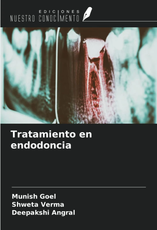 Tratamiento en endodoncia