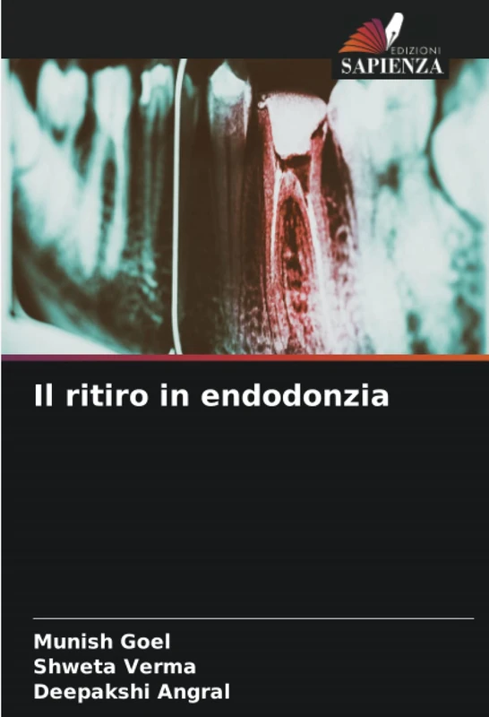 Il ritiro in endodonzia