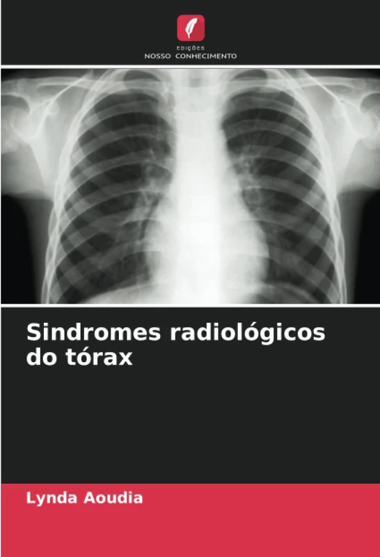 Sindromes radiológicos do tórax