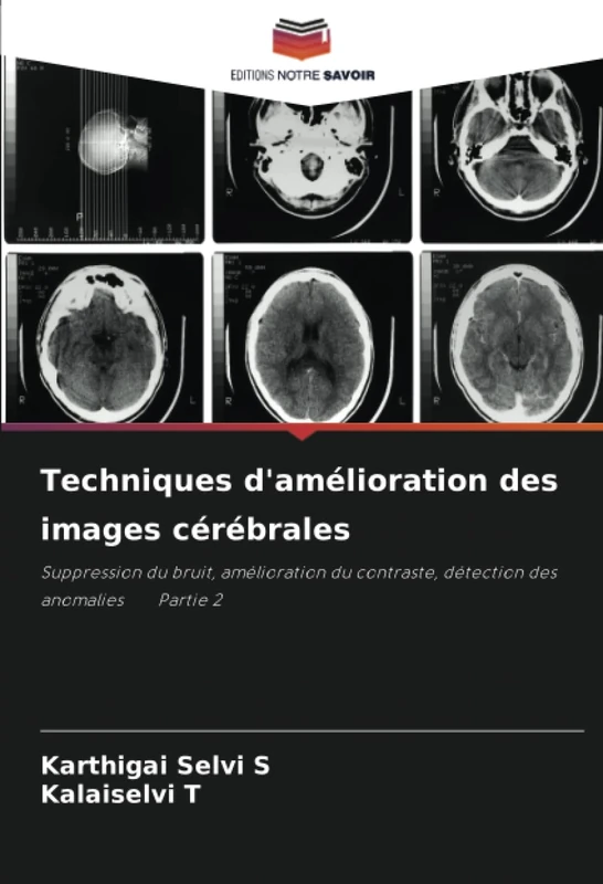 Techniques d'amélioration des images cérébrales: Suppression du bruit, amélioration du contraste, détection des anomalies Partie 2