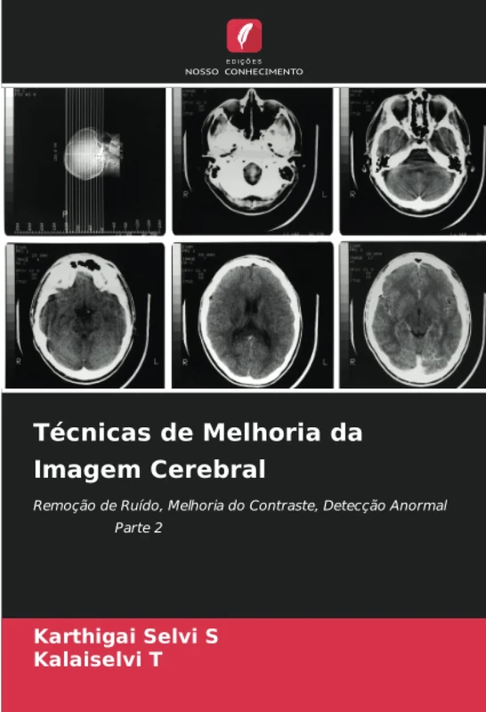 Técnicas de Melhoria da Imagem Cerebral: Remoção de Ruído, Melhoria do Contraste, Detecção Anormal Parte 2