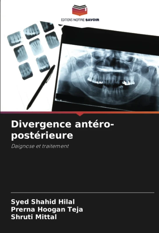 Divergence antéro-postérieure: Daignose et traitement