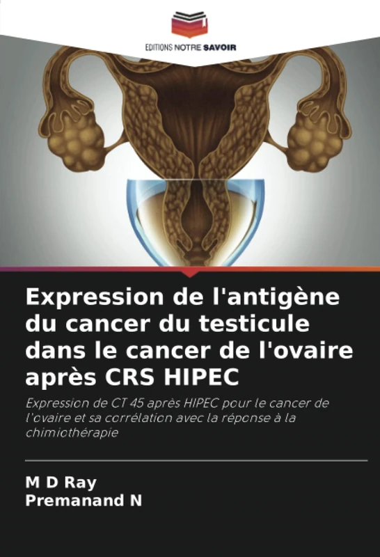 Expression de l'antigène du cancer du testicule dans le cancer de l'ovaire après CRS HIPEC: Expression de CT 45 après HIPEC pour le cancer de l'ovaire ... avec la réponse à la chimiothérapie