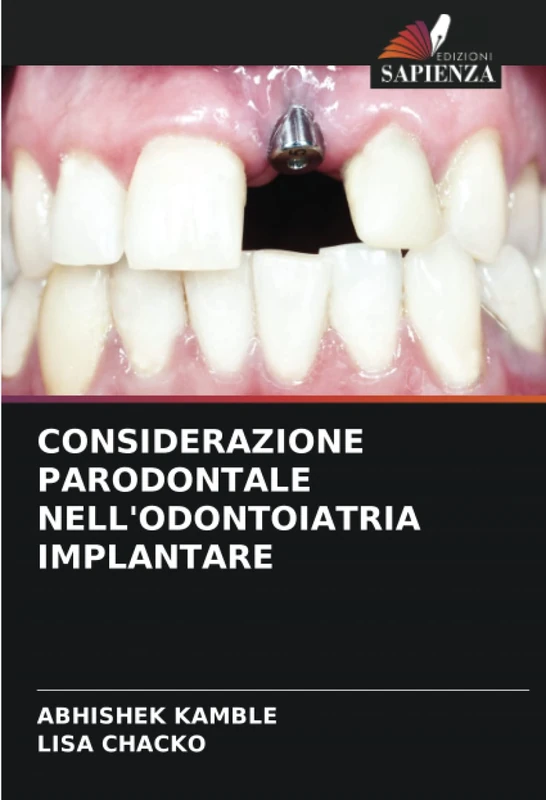 CONSIDERAZIONE PARODONTALE NELL'ODONTOIATRIA IMPLANTARE