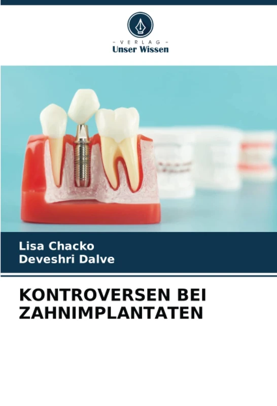 KONTROVERSEN BEI ZAHNIMPLANTATEN