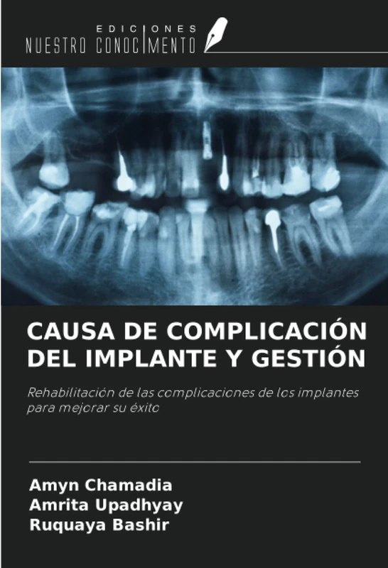 CAUSA DE COMPLICACIÓN DEL IMPLANTE Y GESTIÓN: Rehabilitación de las complicaciones de los implantes para mejorar su éxito