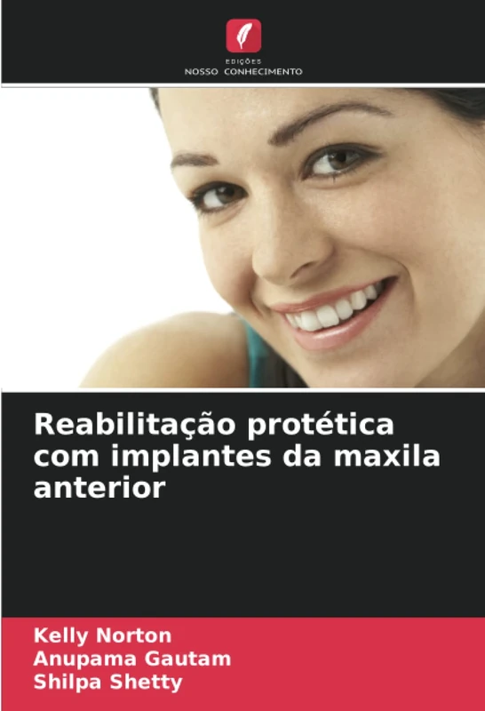 Reabilitação protética com implantes da maxila anterior