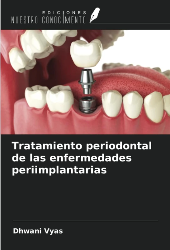 Tratamiento periodontal de las enfermedades periimplantarias