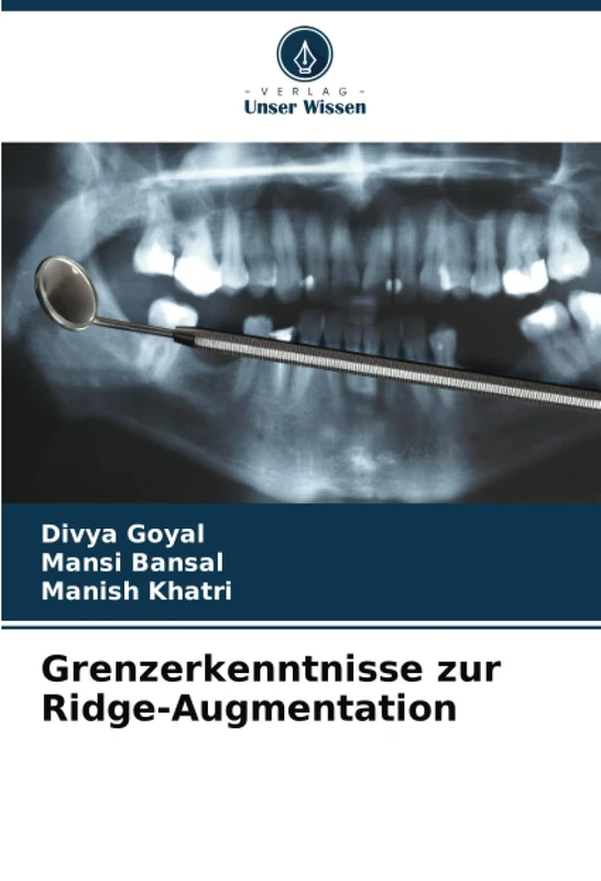 Grenzerkenntnisse zur Ridge-Augmentation - Image 1