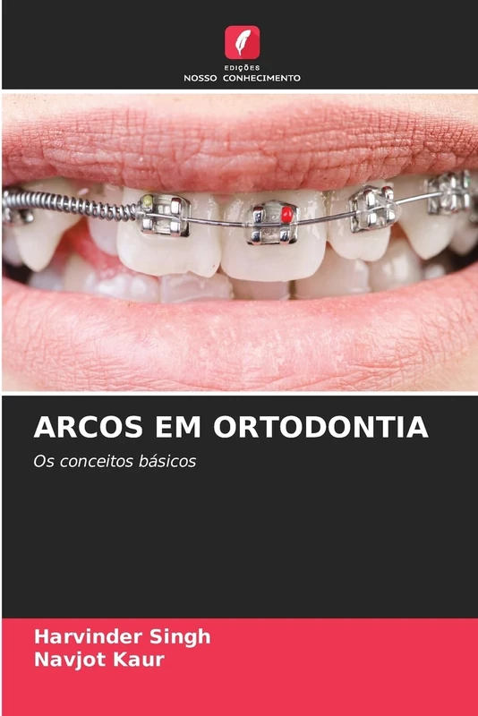Arcos Em Ortodontia: Os conceitos básicos