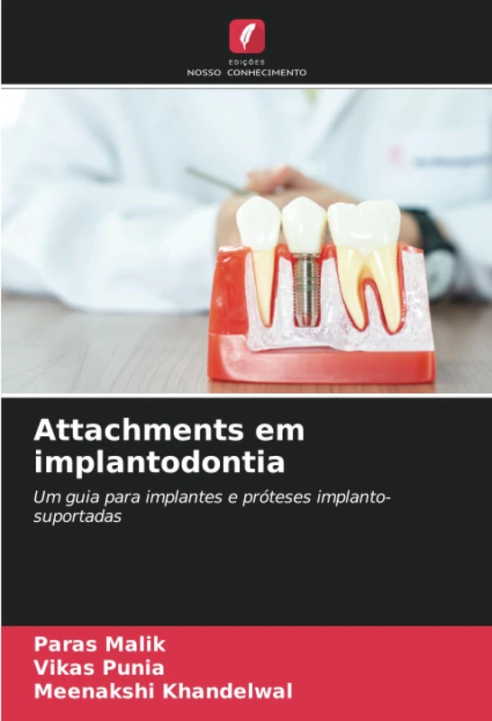 Attachments em implantodontia: Um guia para implantes e próteses implanto-suportadas