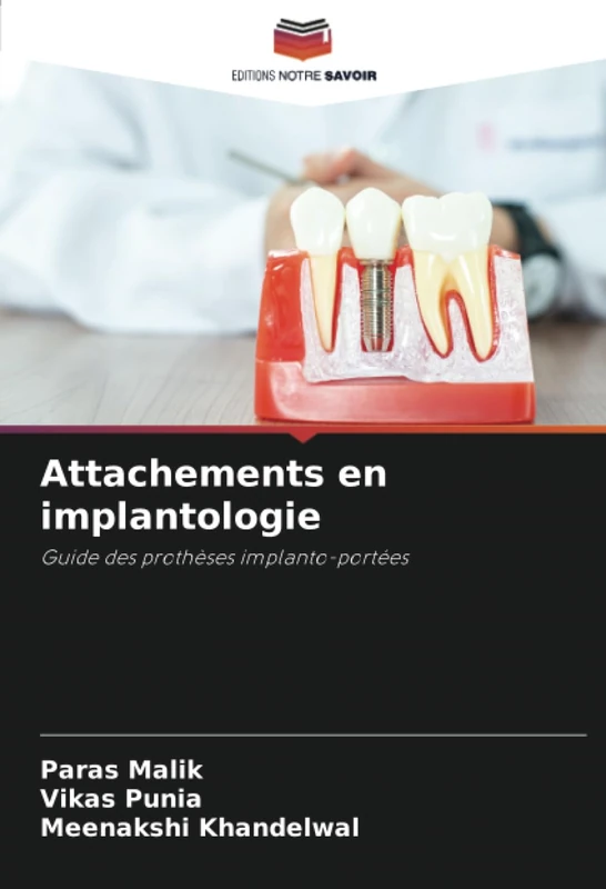 Attachements en implantologie: Guide des prothèses implanto-portées