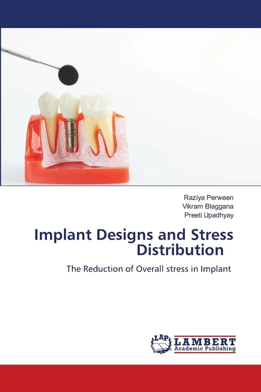 Implant Designs and Stress Distribution: The Reduction of Overall stress in Implant