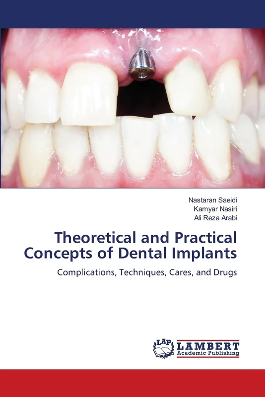 Theoretical and Practical Concepts of Dental Implants: Complications, Techniques, Cares, and Drugs