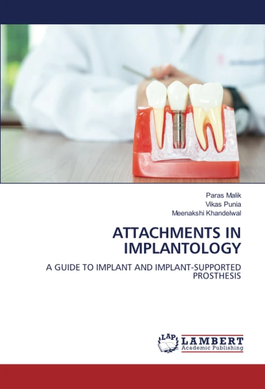 ATTACHMENTS IN IMPLANTOLOGY: A GUIDE TO IMPLANT AND IMPLANT-SUPPORTED PROSTHESIS