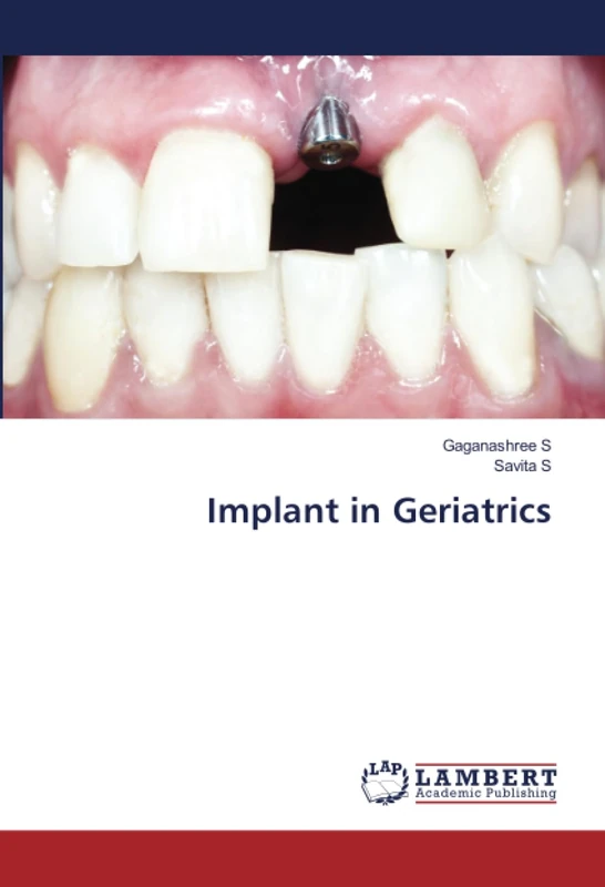 Implant in Geriatrics