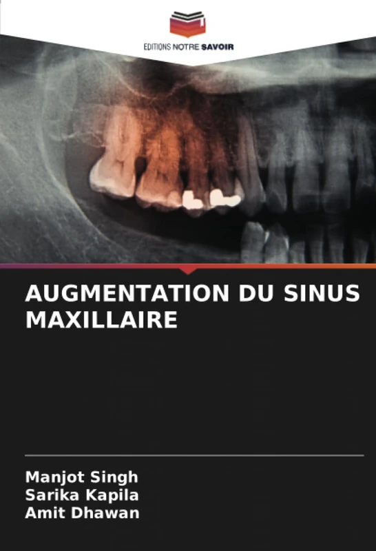 AUGMENTATION DU SINUS MAXILLAIRE