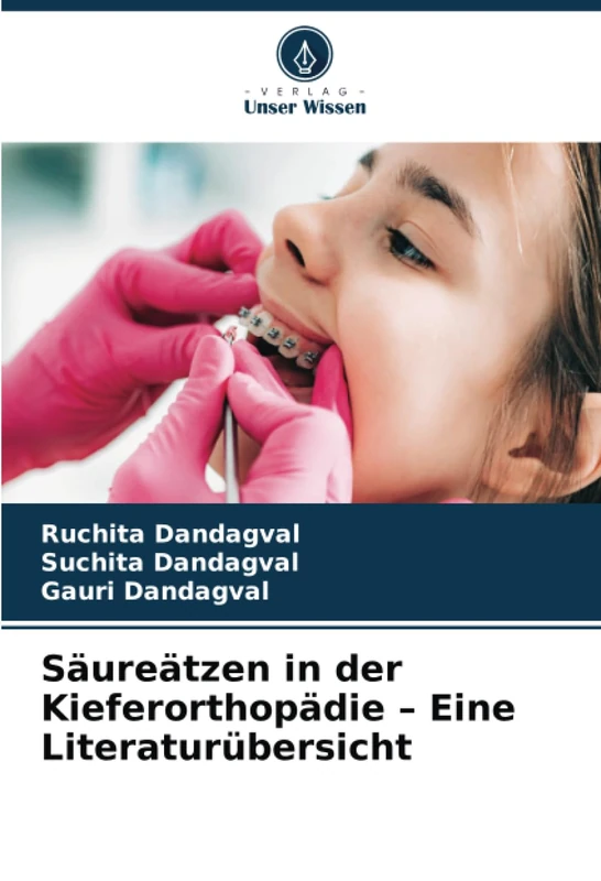 Säureätzen in der Kieferorthopädie – Eine Literaturübersicht