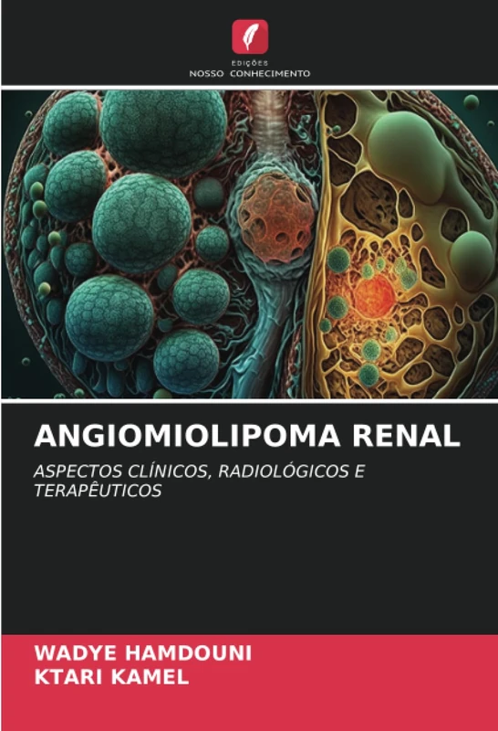ANGIOMIOLIPOMA RENAL: ASPECTOS CLÍNICOS, RADIOLÓGICOS E TERAPÊUTICOS