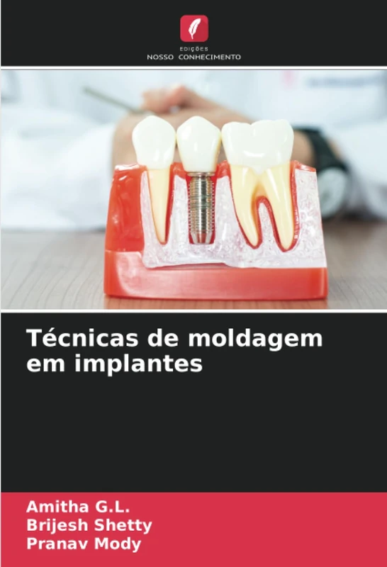 Técnicas de moldagem em implantes