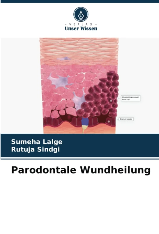 Parodontale Wundheilung