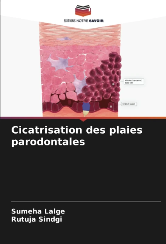 Cicatrisation des plaies parodontales