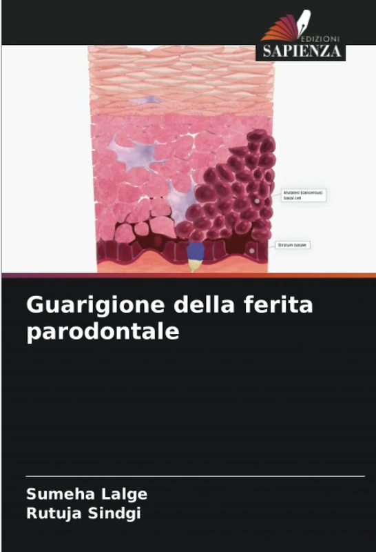 Guarigione della ferita parodontale