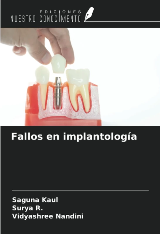 Fallos en implantología