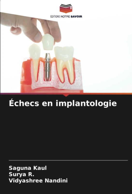 Échecs en implantologie