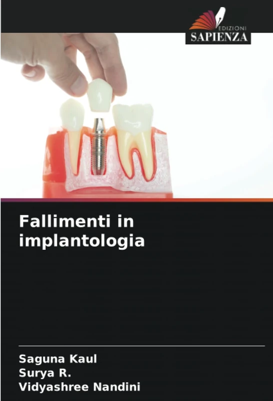 Fallimenti in implantologia