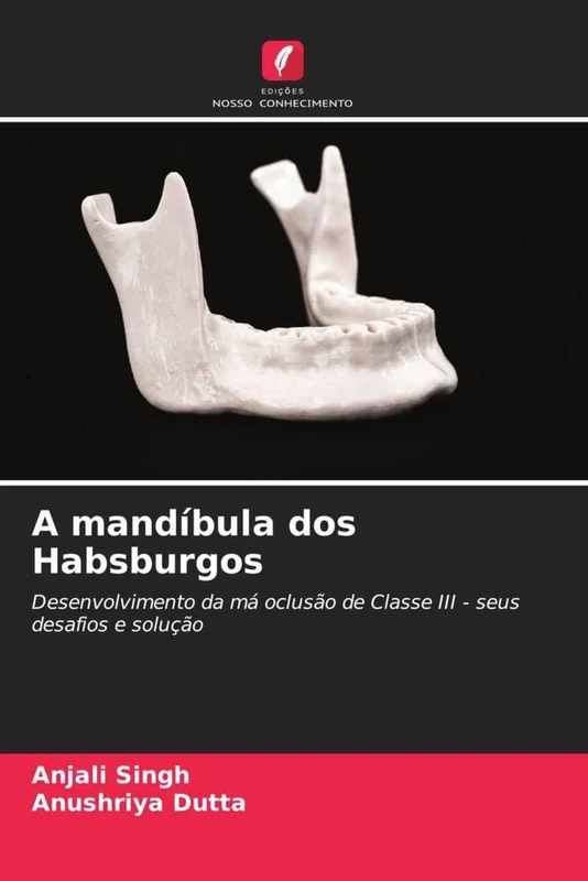 A mandíbula dos Habsburgos: Desenvolvimento da má oclusão de Classe III - seus desafios e solução