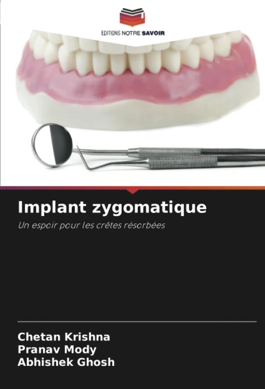 Implant zygomatique: Un espoir pour les crêtes résorbées