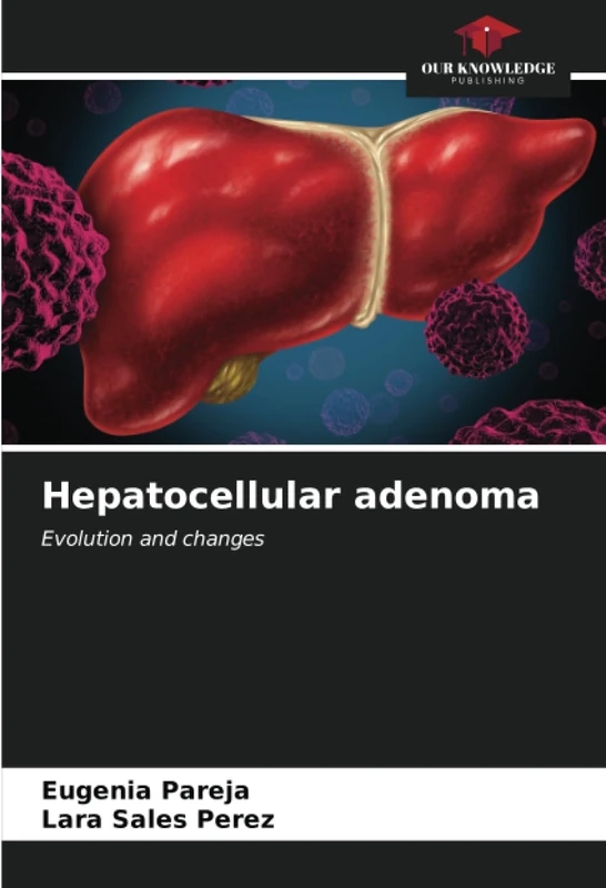 Hepatocellular adenoma: Evolution and changes