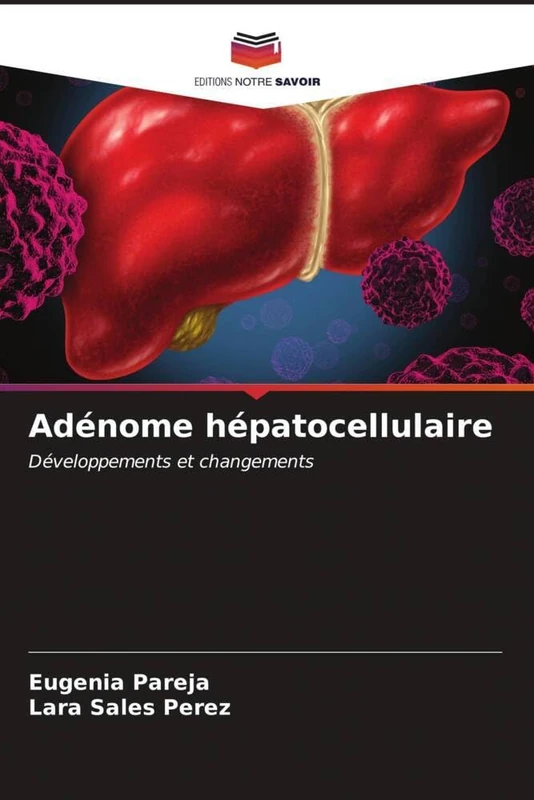 Adénome hépatocellulaire: Développements et changements - Image 1